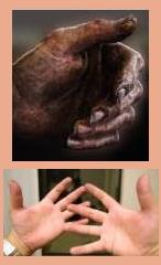 Hands